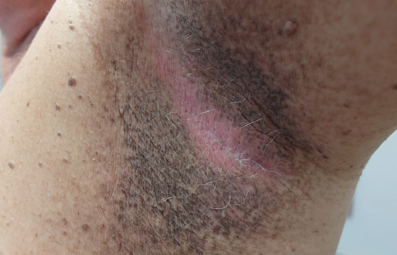 Blickdiagnose-Quiz Fall 8: klinisches Bild – welche Diagnose?