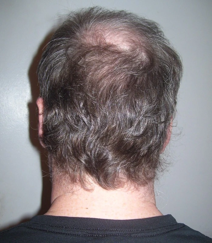 Blickdiagnose-Quiz Fall 4: klinisches Bild – welche Diagnose?