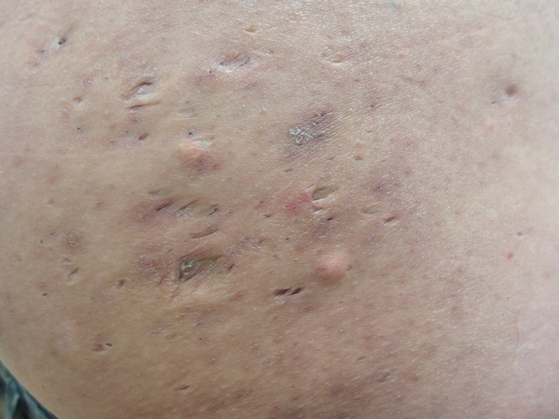 Blickdiagnose-Quiz Fall 1: klinisches Bild – welche Diagnose?