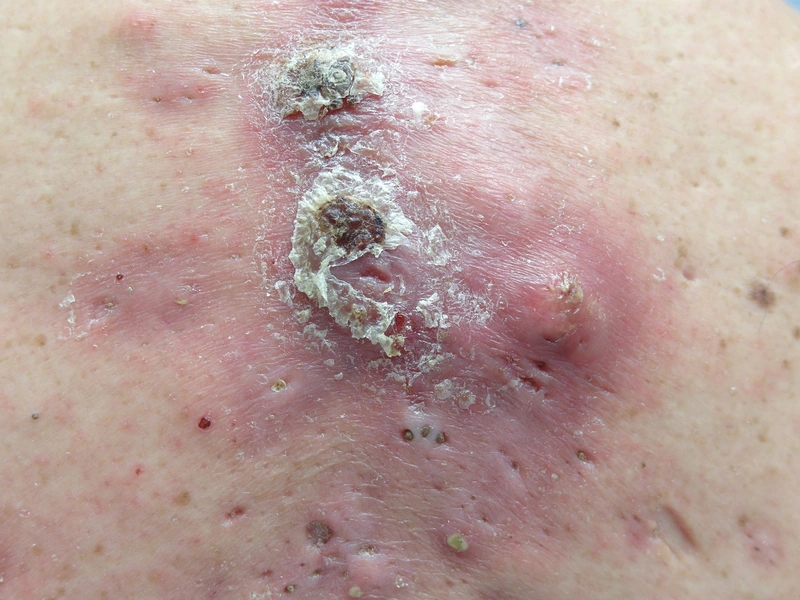 Blickdiagnose-Quiz Fall 16: klinisches Bild – welche Diagnose?