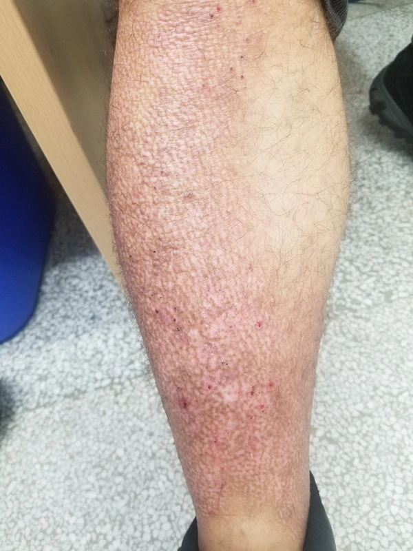 Blickdiagnose-Quiz Fall 17: klinisches Bild – welche Diagnose?