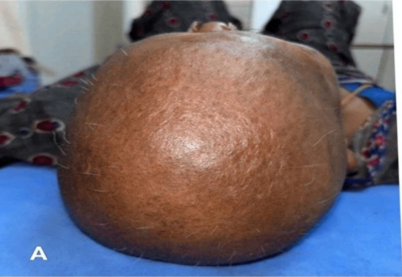 Blickdiagnose-Quiz Fall 6: klinisches Bild – welche Diagnose?
