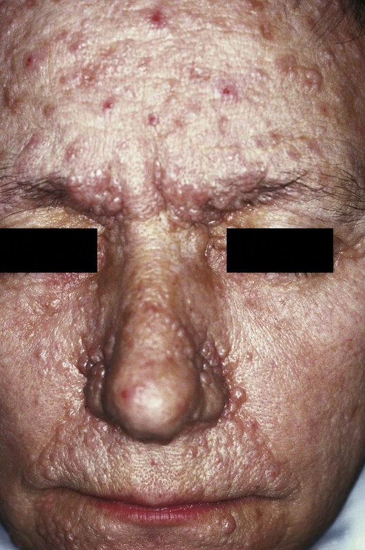Spot-diagnosis quiz case 19: clinical image – which diagnosis?