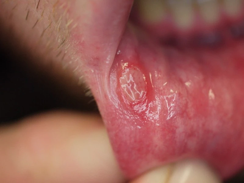 Blickdiagnose-Quiz Fall 7: klinisches Bild – welche Diagnose?