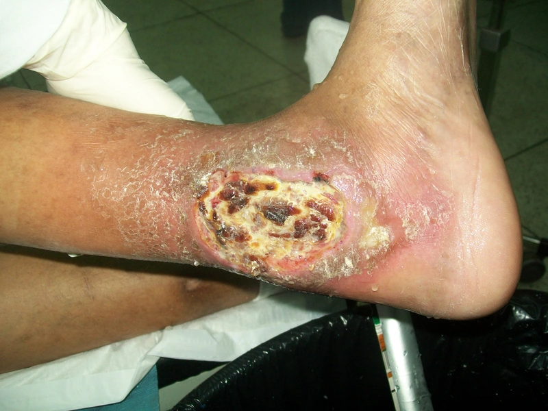 Blickdiagnose-Quiz Fall 6: klinisches Bild – welche Diagnose?