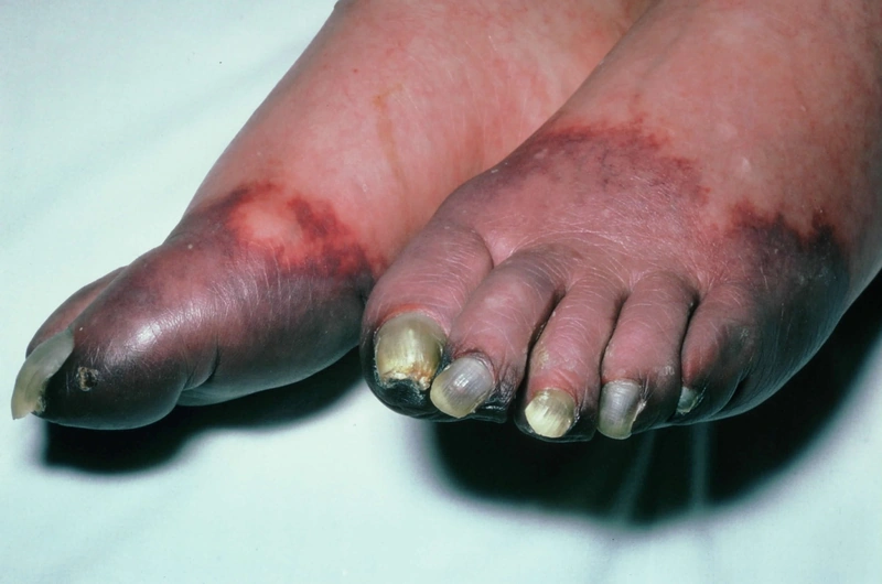 Blickdiagnose-Quiz Fall 7: klinisches Bild – welche Diagnose?