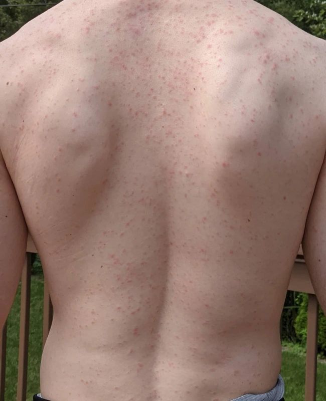 Blickdiagnose-Quiz Fall 18: klinisches Bild – welche Diagnose?