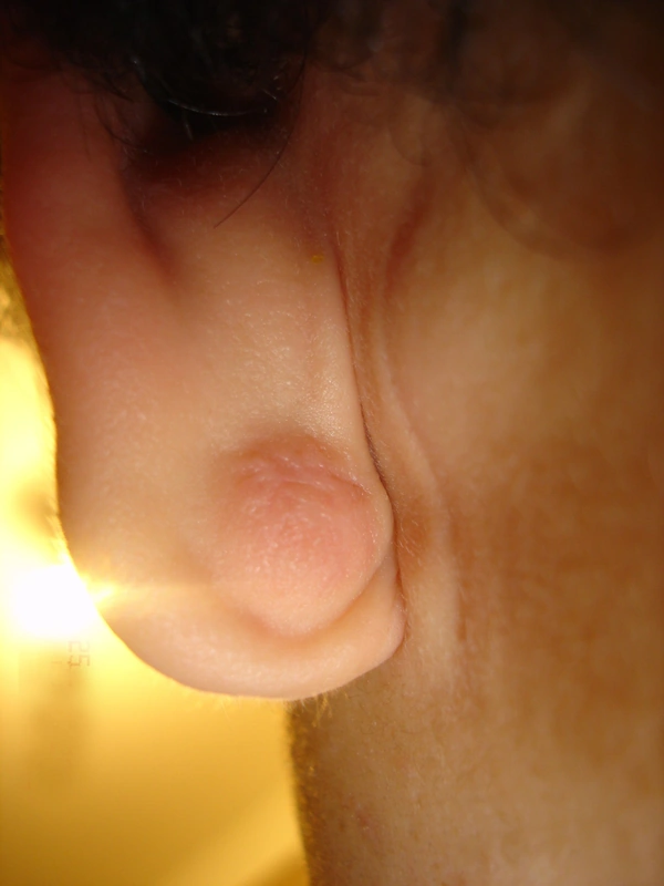 Spot-diagnosis quiz case 21: clinical image – which diagnosis?