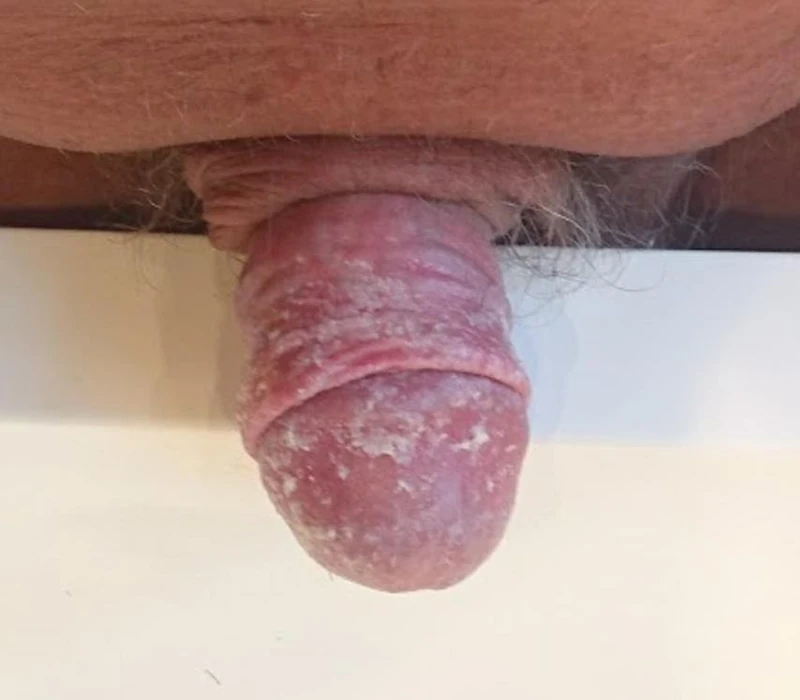 Blickdiagnose-Quiz Fall 19: klinisches Bild – welche Diagnose?