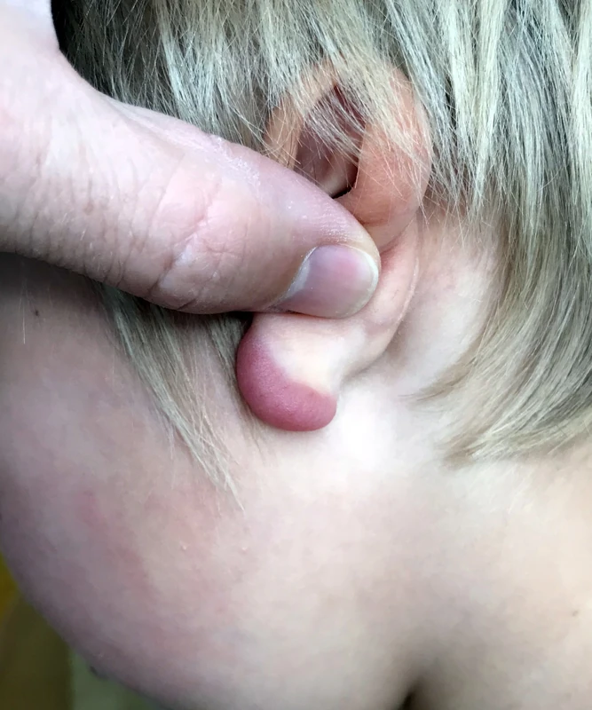Blickdiagnose-Quiz Fall 48: klinisches Bild – welche Diagnose?
