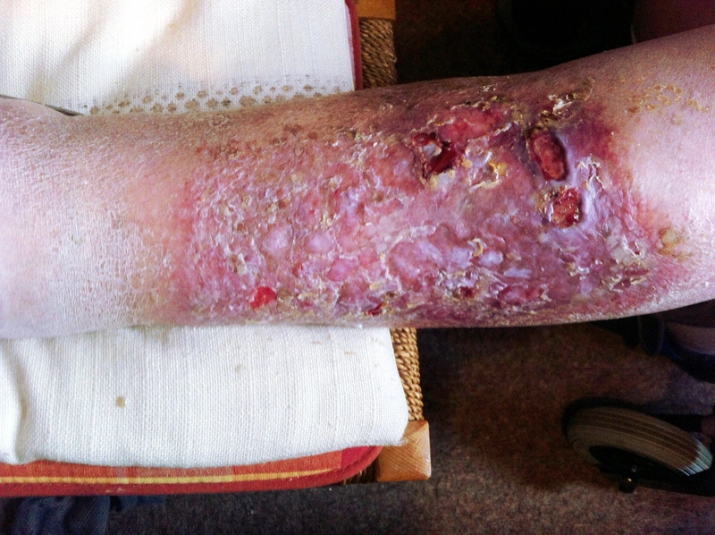 Blickdiagnose-Quiz Fall 8: klinisches Bild – welche Diagnose?