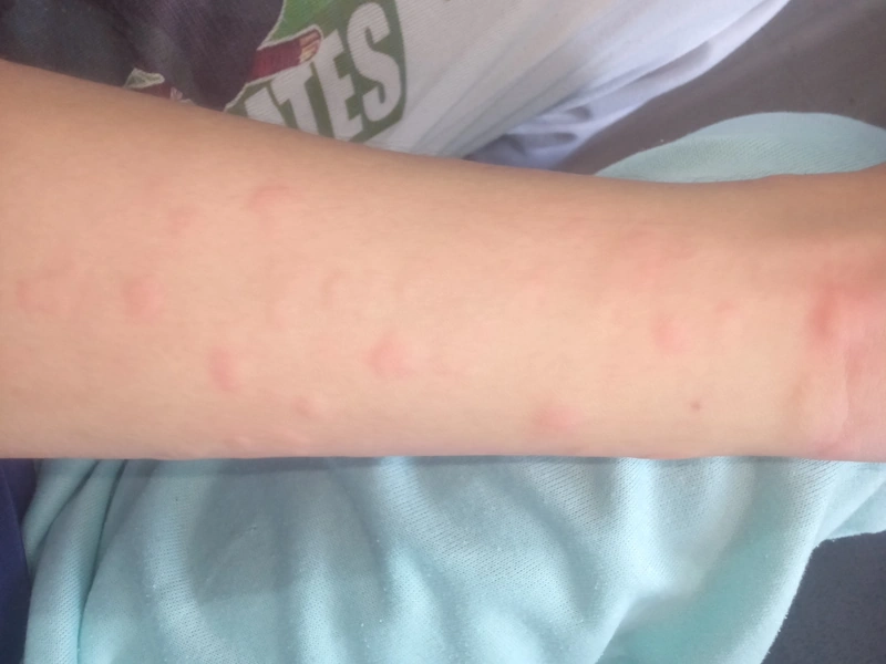 Blickdiagnose-Quiz Fall 2: klinisches Bild – welche Diagnose?