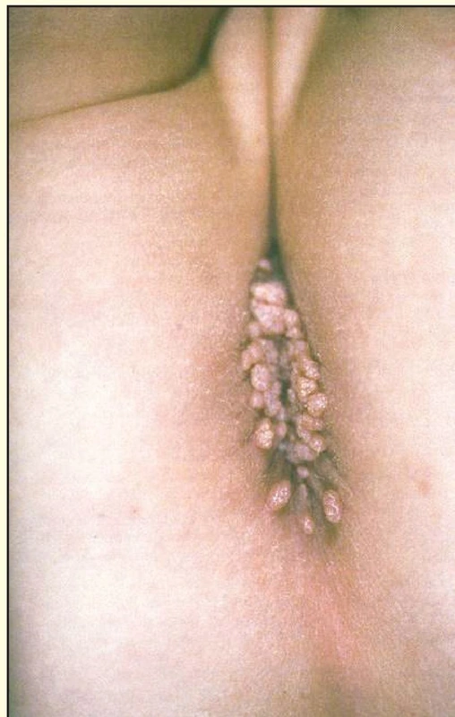 Blickdiagnose-Quiz Fall 3: klinisches Bild – welche Diagnose?