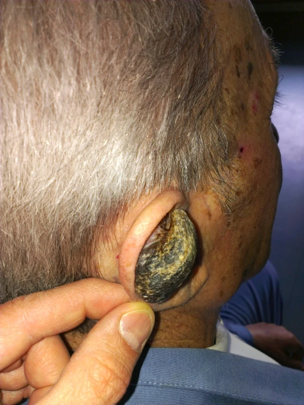 Spot-diagnosis quiz case 4: clinical image – which diagnosis?