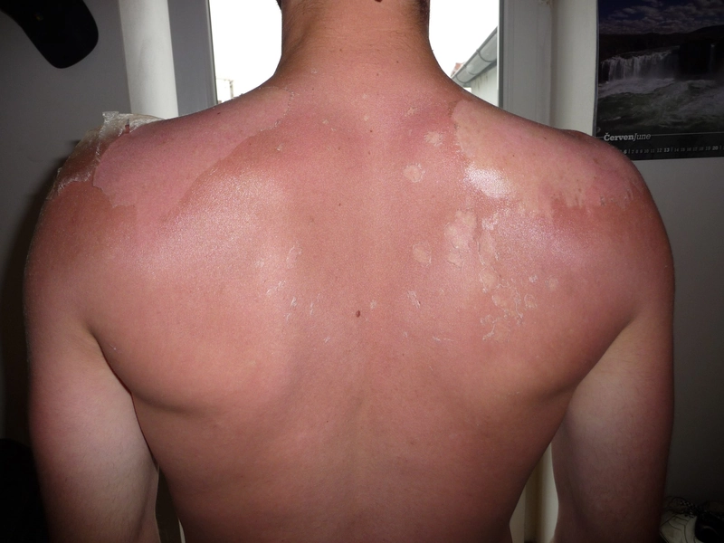 Blickdiagnose-Quiz Fall 4: klinisches Bild – welche Diagnose?