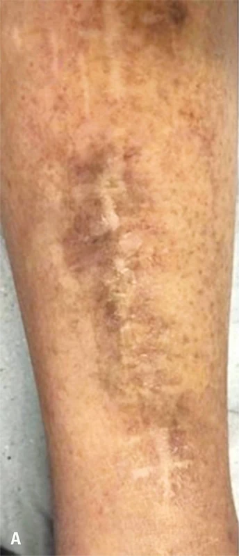 Blickdiagnose-Quiz Fall 9: klinisches Bild – welche Diagnose?