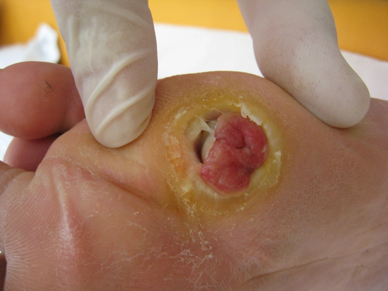 Blickdiagnose-Quiz Fall 10: klinisches Bild – welche Diagnose?