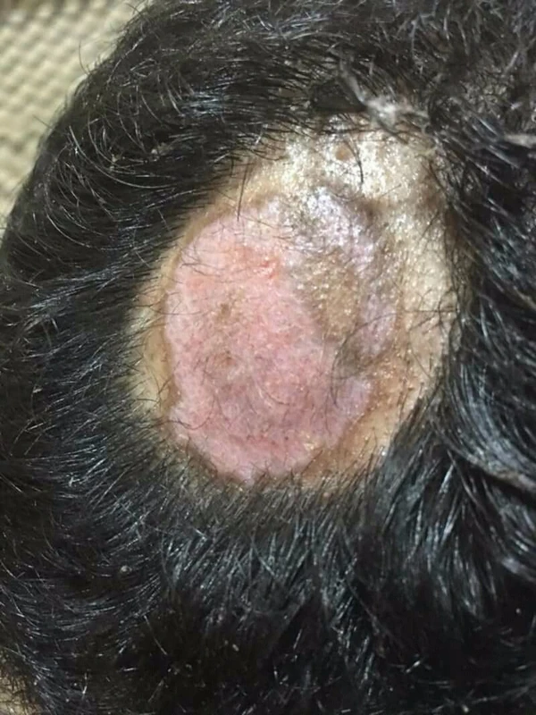 Blickdiagnose-Quiz Fall 21: klinisches Bild – welche Diagnose?