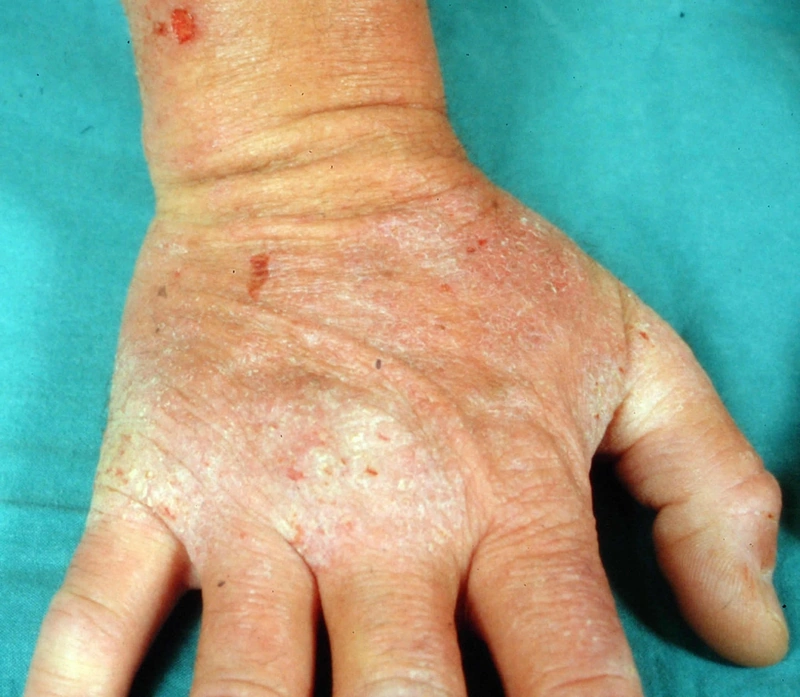 Blickdiagnose-Quiz Fall 22: klinisches Bild – welche Diagnose?
