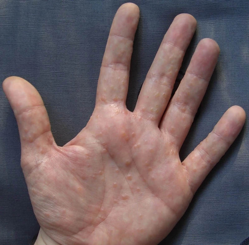 Blickdiagnose-Quiz Fall 5: klinisches Bild – welche Diagnose?