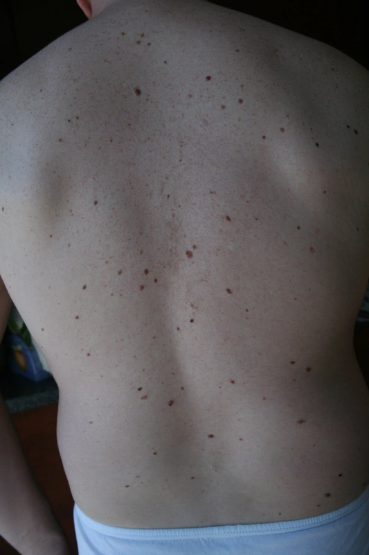 Spot-diagnosis quiz case 6: clinical image – which diagnosis?