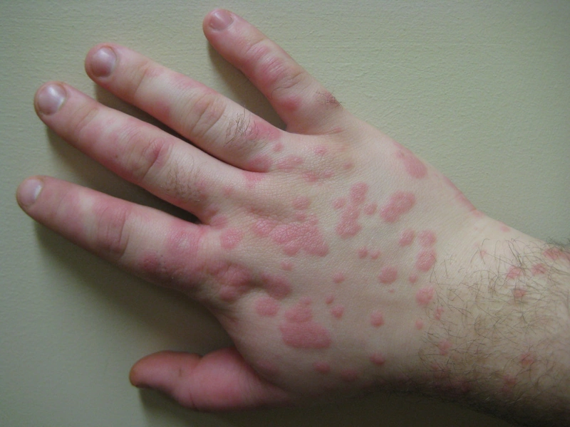 Blickdiagnose-Quiz Fall 24: klinisches Bild – welche Diagnose?