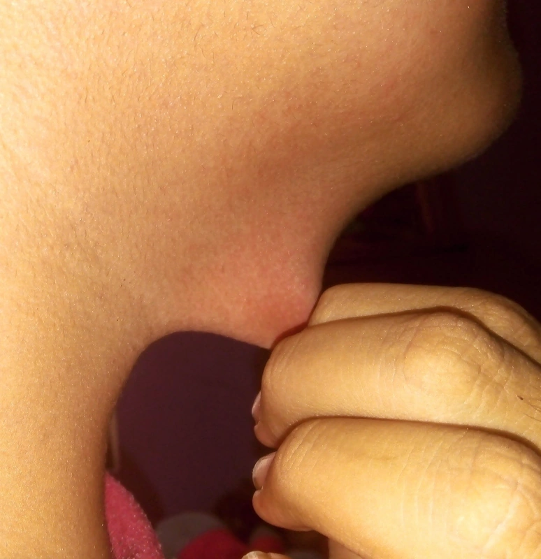 Blickdiagnose-Quiz Fall 2: klinisches Bild – welche Diagnose?