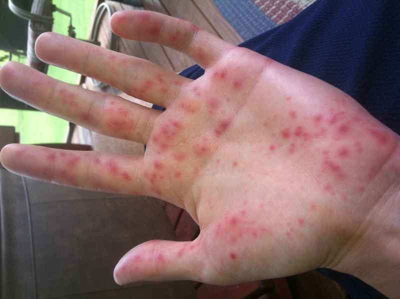 Blickdiagnose-Quiz Fall 17: klinisches Bild – welche Diagnose?