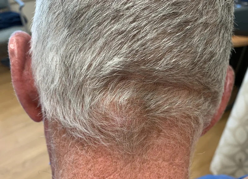 Spot-diagnosis quiz case 7: clinical image – which diagnosis?