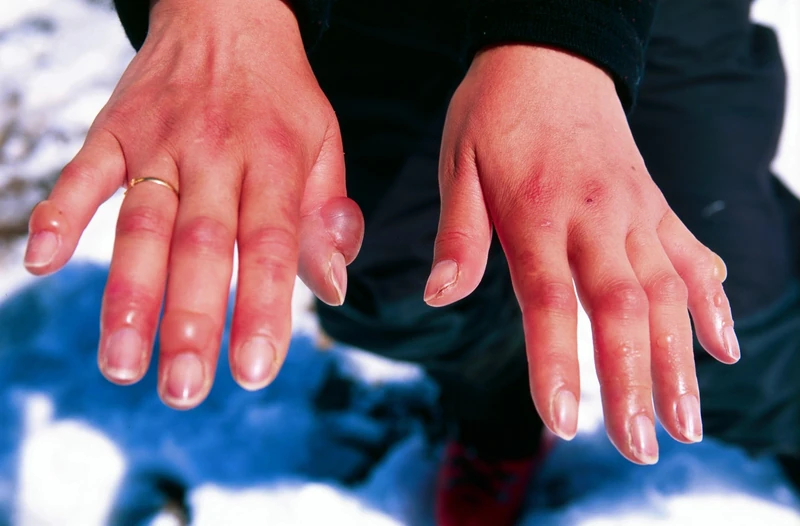 Blickdiagnose-Quiz Fall 11: klinisches Bild – welche Diagnose?
