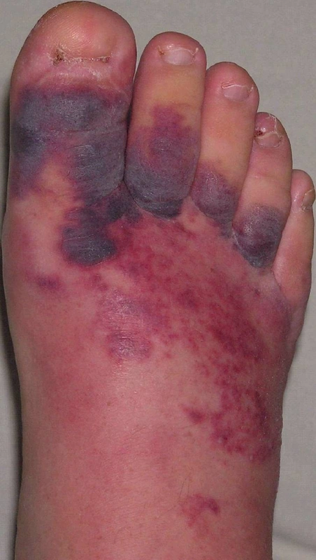 Blickdiagnose-Quiz Fall 18: klinisches Bild – welche Diagnose?