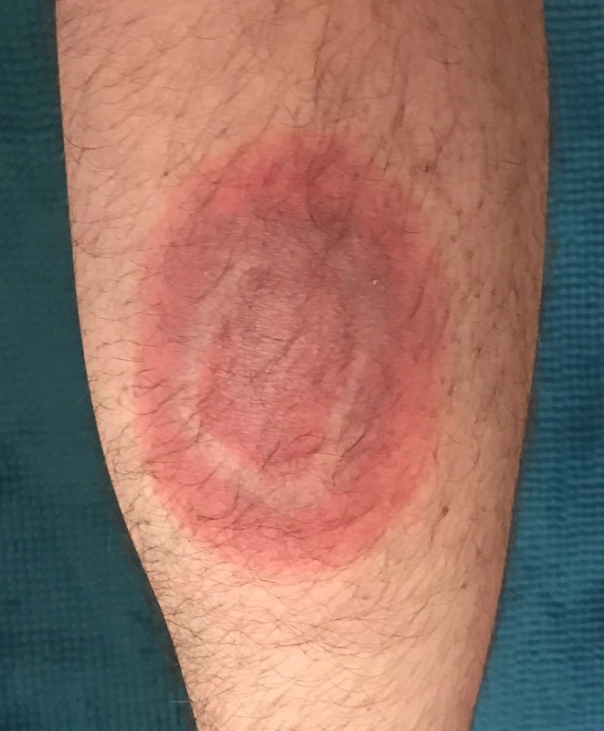 Blickdiagnose-Quiz Fall 6: klinisches Bild – welche Diagnose?