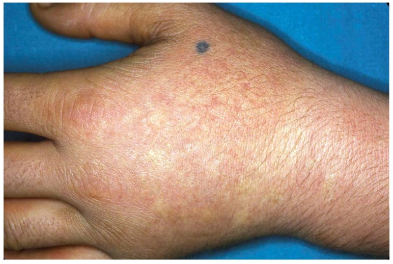Blickdiagnose-Quiz Fall 10: klinisches Bild – welche Diagnose?