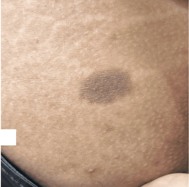 Blickdiagnose-Quiz Fall 26: klinisches Bild – welche Diagnose?