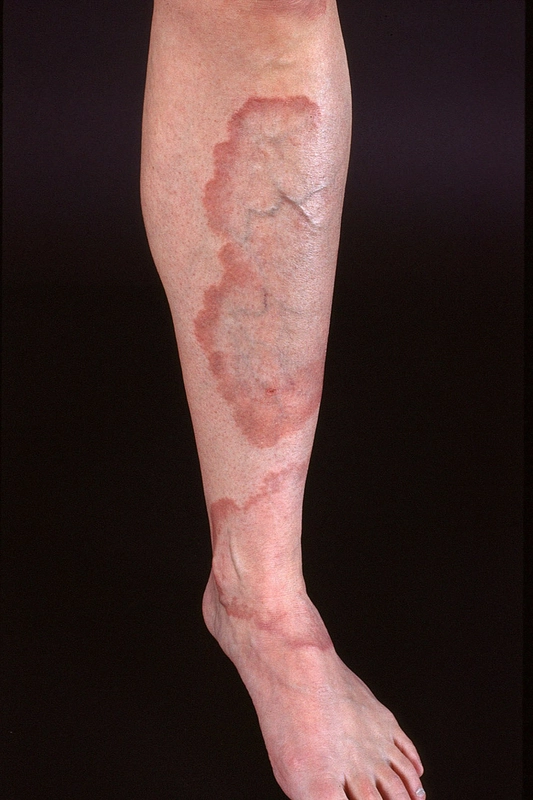 Blickdiagnose-Quiz Fall 27: klinisches Bild – welche Diagnose?