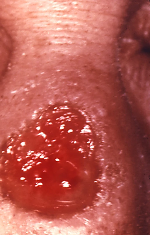 Blickdiagnose-Quiz Fall 22: klinisches Bild – welche Diagnose?