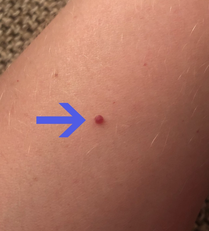 Spot-diagnosis quiz case 24: clinical image – which diagnosis?