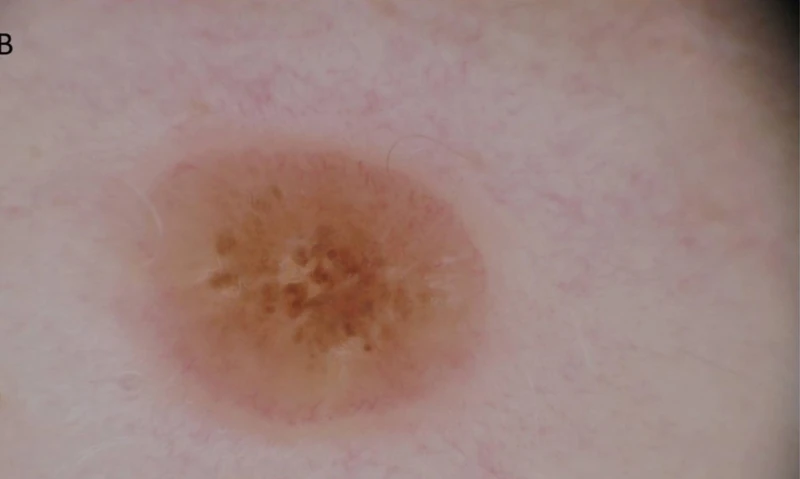 Spot-diagnosis quiz case 25: clinical image – which diagnosis?