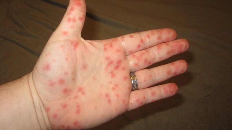 Blickdiagnose-Quiz Fall 23: klinisches Bild – welche Diagnose?