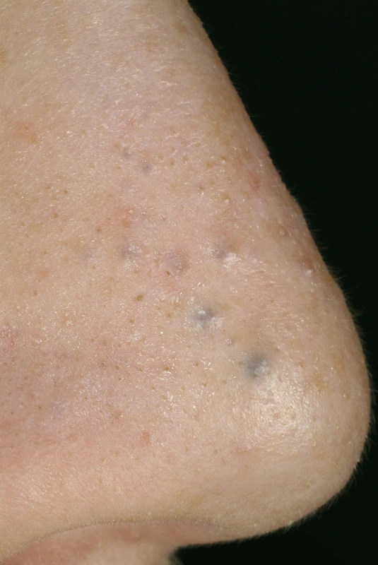 Spot-diagnosis quiz case 26: clinical image – which diagnosis?