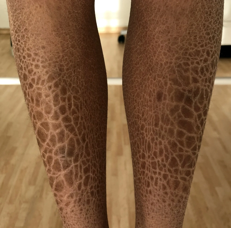 Blickdiagnose-Quiz Fall 13: klinisches Bild – welche Diagnose?