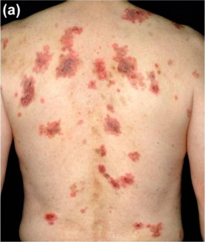 Blickdiagnose-Quiz Fall 28: klinisches Bild – welche Diagnose?