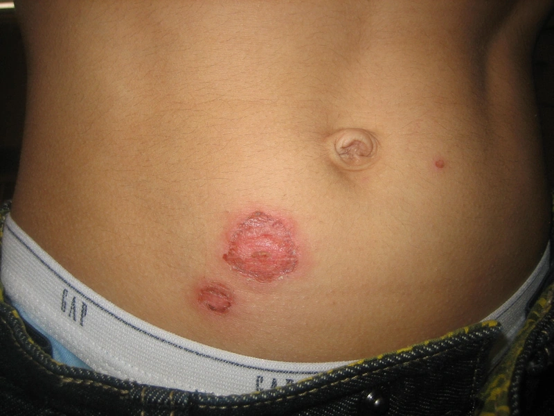 Blickdiagnose-Quiz Fall 27: klinisches Bild – welche Diagnose?