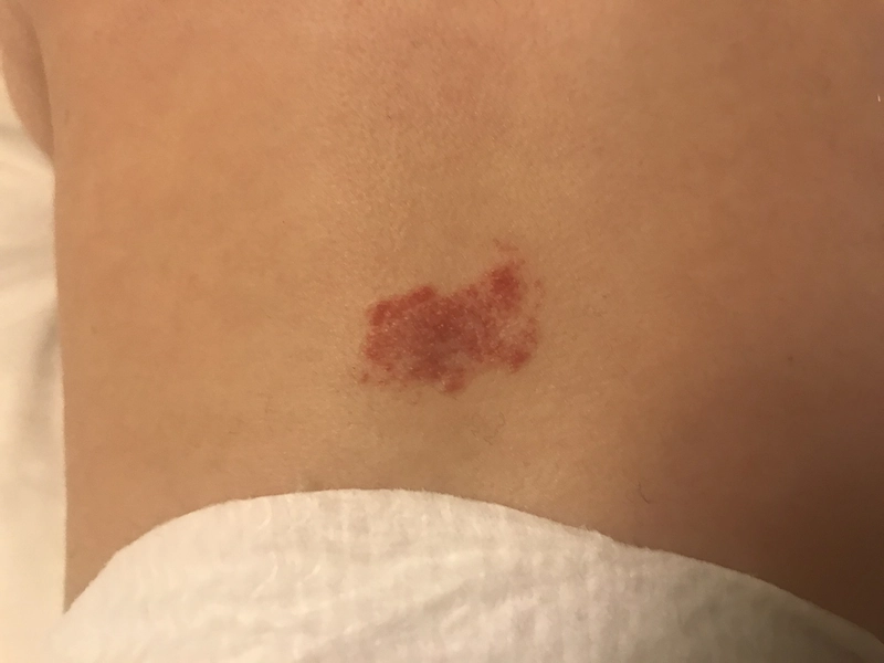 Spot-diagnosis quiz case 27: clinical image – which diagnosis?