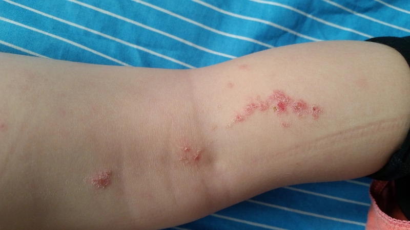 Blickdiagnose-Quiz Fall 4: klinisches Bild – welche Diagnose?