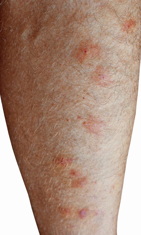 Blickdiagnose-Quiz Fall 28: klinisches Bild – welche Diagnose?