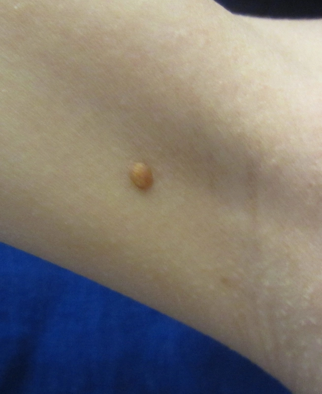 Spot-diagnosis quiz case 38: clinical image – which diagnosis?