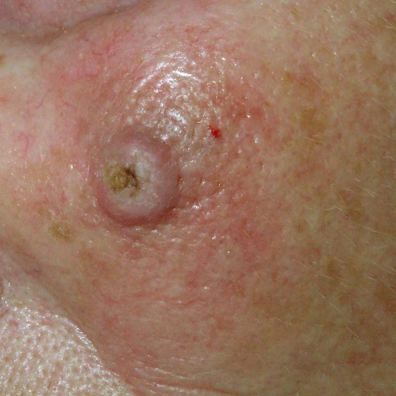 Spot-diagnosis quiz case 28: clinical image – which diagnosis?