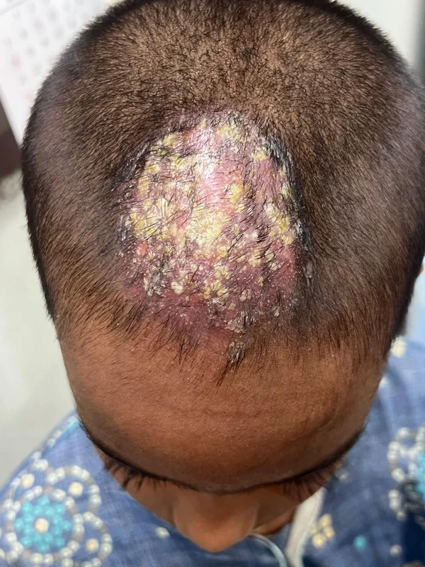 Blickdiagnose-Quiz Fall 29: klinisches Bild – welche Diagnose?