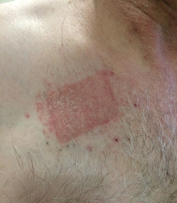 Blickdiagnose-Quiz Fall 31: klinisches Bild – welche Diagnose?